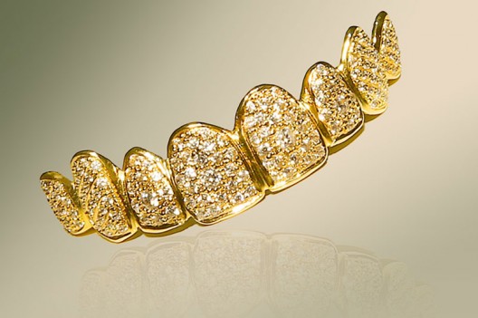 World's Most Expensive Denture