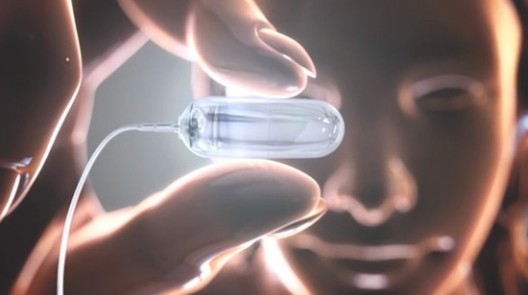 A $4,000 diet pill expands into a balloon in your stomach to take off 20-30 Lbs